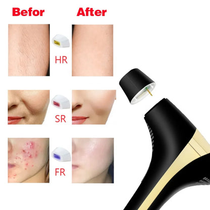 GlowFreezePro™ Flashes Laser Epilator