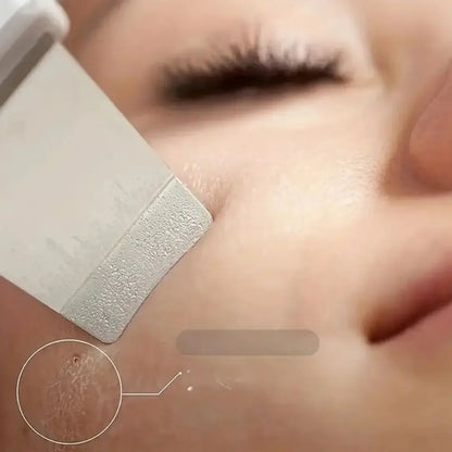 Skin Scrubber Deep Vibrate Facial Cleaner Shovel Spatula Not Ultrasonic Face Scrubber Peeling Blackhead Remover Facial Massager